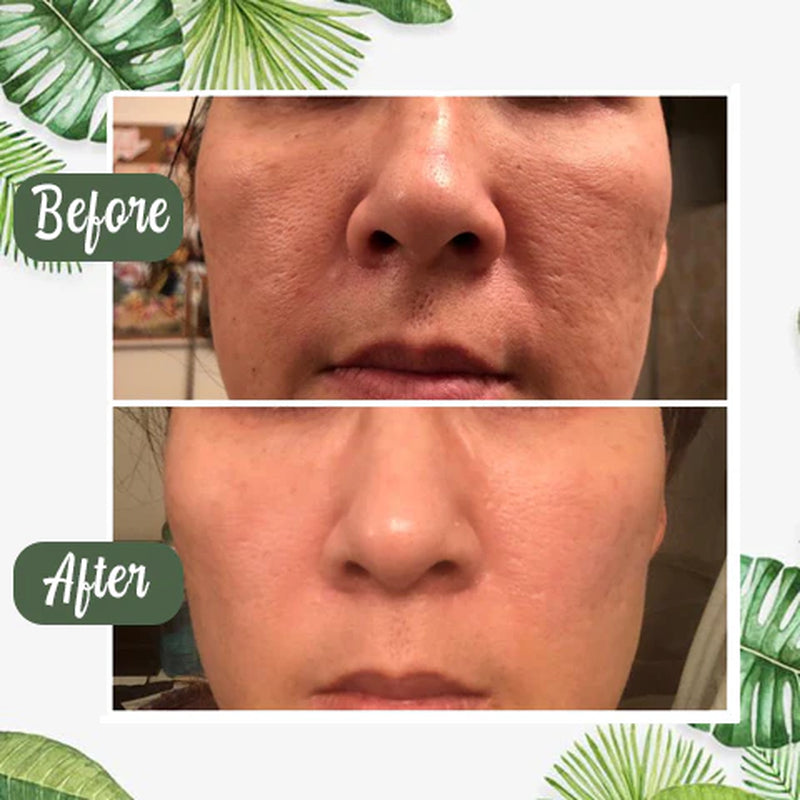 Purifymist™ — Unleash Clear, Radiant Skin That Glows with Confidence