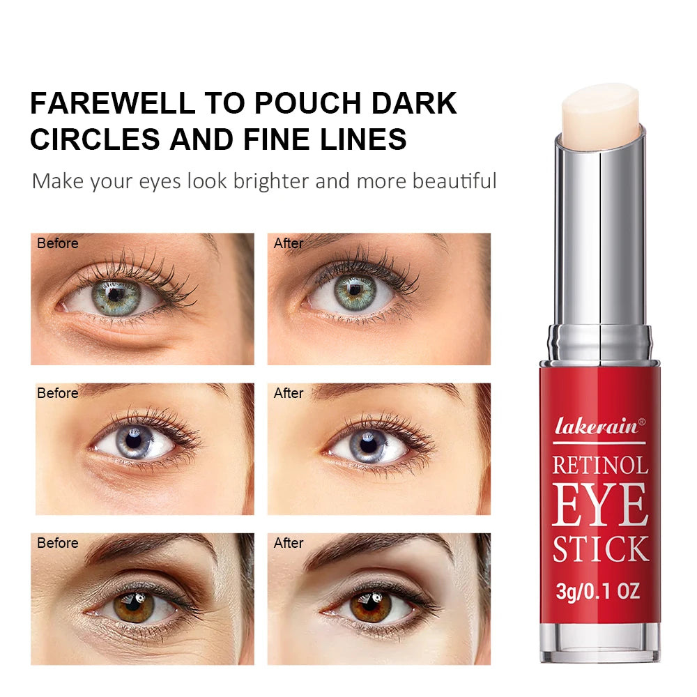 Revitalize Your Eyes with Our Retinol Eye Cream Stick - Brighten Dark Circles and Firm Skin Instantly!