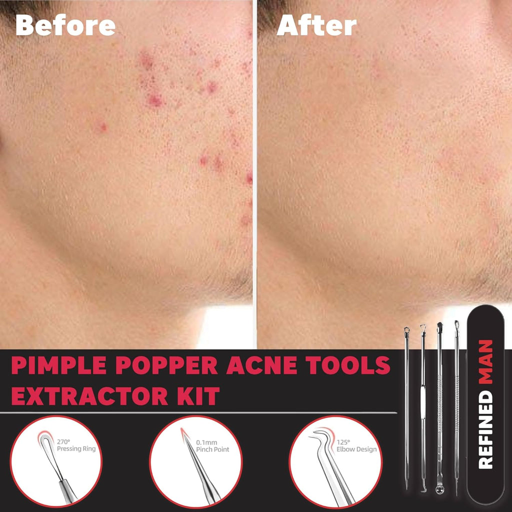 - Refined Man - 4 Piece Blemish Extractor with Case - Pimple Popper Acne Tools Extractor Kit - Stainless Steel Multi-Tip Acne Popper Tool - Designed for Men