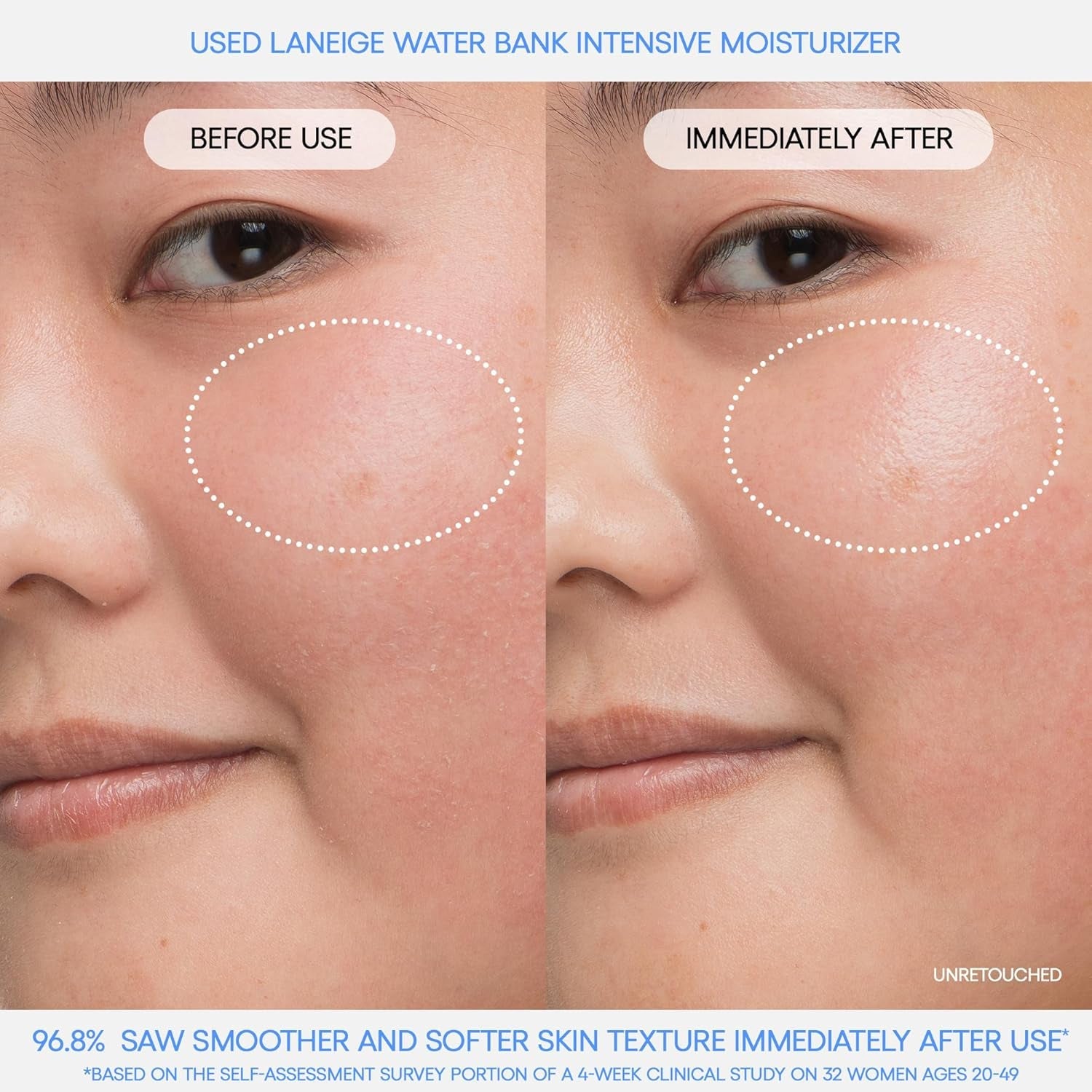 Hyaluronic Intensive Moisturizer - Cosmetics Store