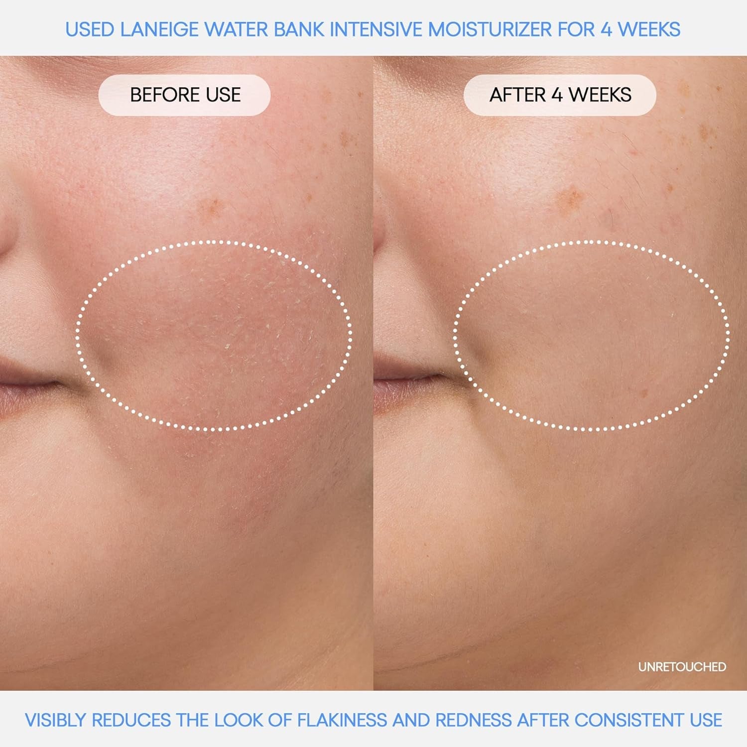 Hyaluronic Intensive Moisturizer - Cosmetics Store