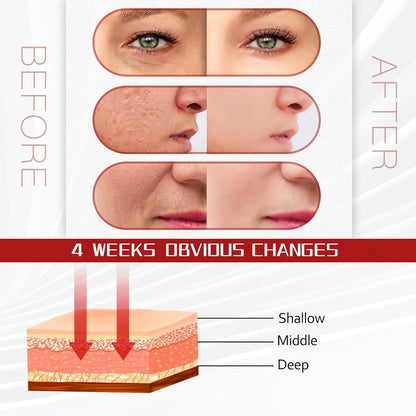 LED Face Mask Light Therapy - Cosmetics Store