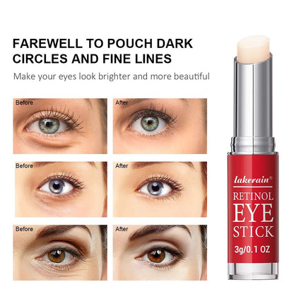 Revitalize Your Eyes with Our Retinol Eye Cream Stick - Brighten Dark Circles and Firm Skin Instantly! - Cosmetics Store